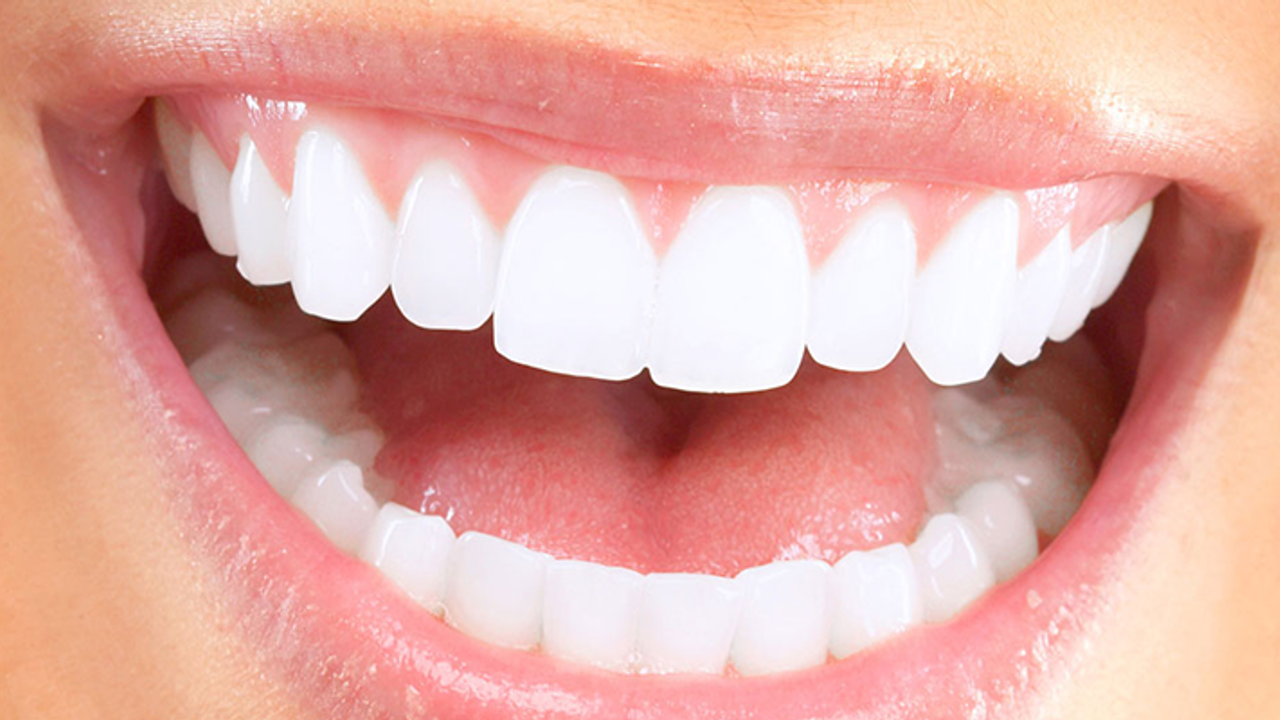 Diş beyazlatma yöntemleri neler? Beyazlatmak dişlere zarar verir mi?