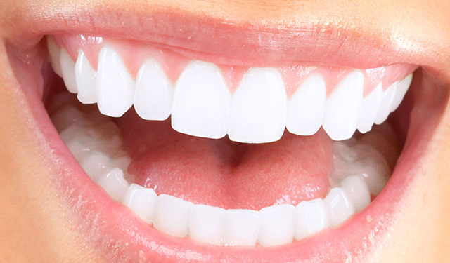 Diş beyazlatma yöntemleri neler? Beyazlatmak dişlere zarar verir mi?